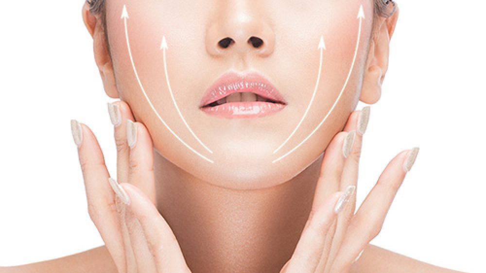 threadlift